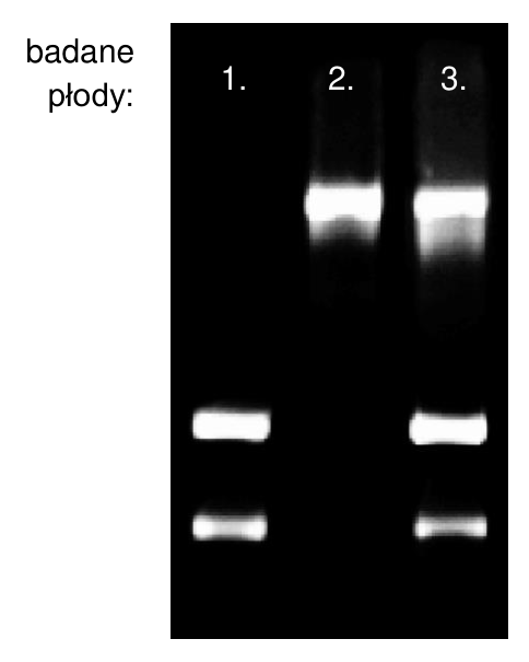 Wynik rozdziału fragmentów DNA dla badanych płodów 1., 2. i 3.