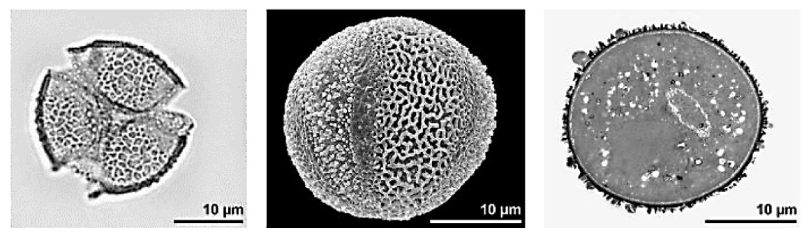 Trzy zdjęcia mikroskopowe ziaren pyłku; na każdym widoczna podziałka 10 µm.