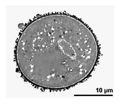 Trzecie zdjęcie ziarna pyłku; podziałka 10 µm.