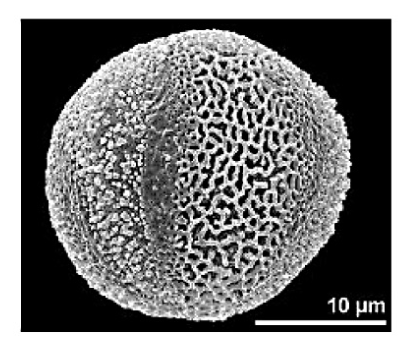 Drugie zdjęcie ziarna pyłku; podziałka 10 µm.